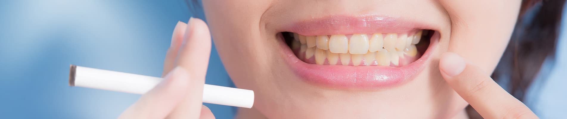 Emergency Crown Placement: A Quick Guide to Dental Recovery